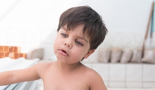 Causas del hipertiroidismo en niños