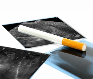 ¿Cómo afecta el tabaco en la fertilidad?