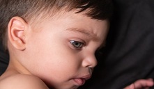 Mielitis flácida aguda causada por enterovirus d68