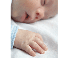 polidactilia y sindactilia