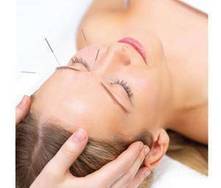 Acupuntura y fertilidad