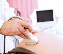 Placenta calcificada en la semana 37