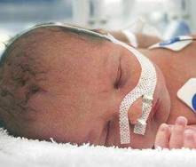 Daños cerebrales en bebés prematuros