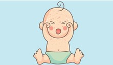 ¿Cómo cuidar a un bebé con sarampión?
